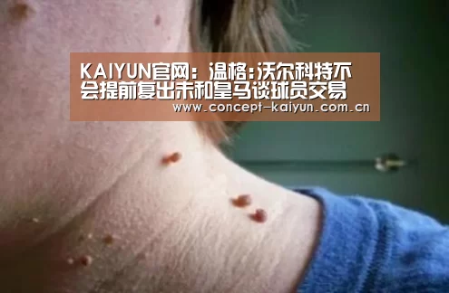 KAIYUN官网：温格:沃尔科特不会提前复出未和皇马谈球员交